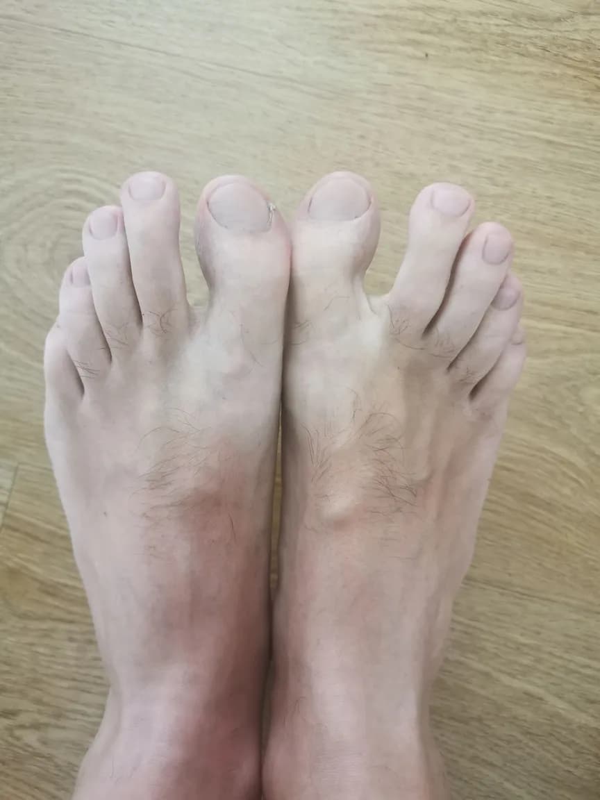 Frenchfeet3 β MYM creator